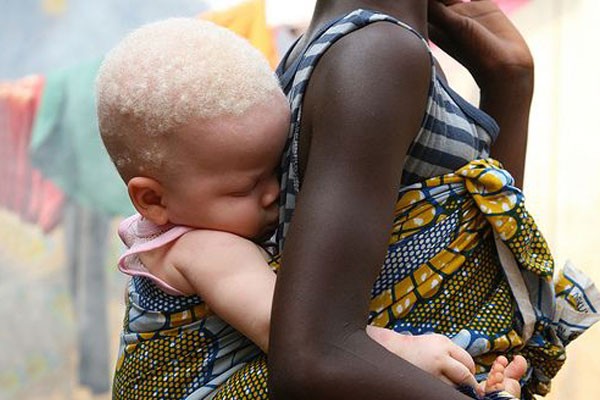 Esta hermana cuidando de su hermanito albino