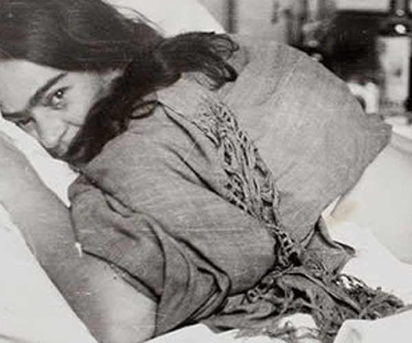 Frida Kahlo luego de una de sus operaciones