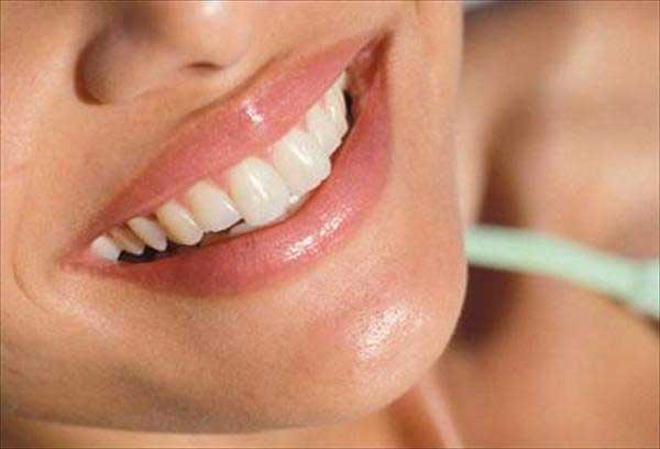 6. Los incómodos dientes amarillos