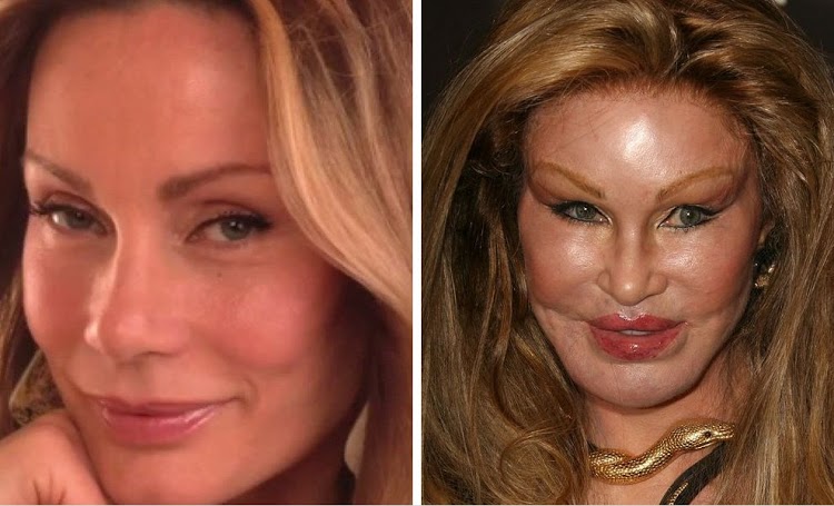 15. Jocelyn Wildenstein