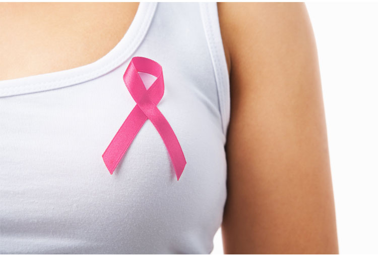 Evitar el cáncer de mama