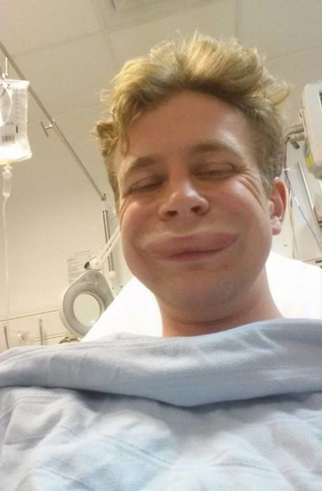 Selfie después de la cirugía