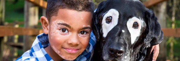 Un niño venció la depresión gracias a un perro con su misma condición