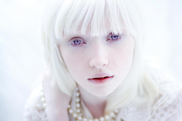 Nastya Zhidkova (La albina más bella del mundo)