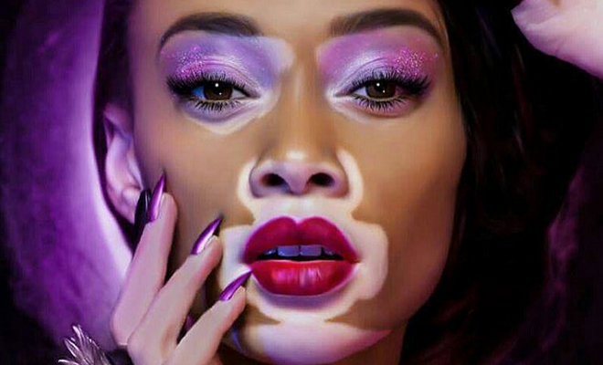 Winnie Harlow es una belleza