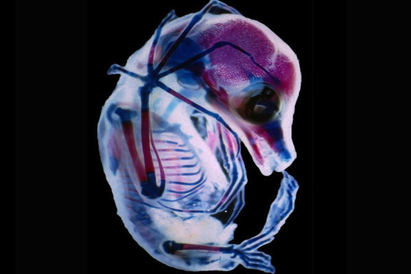 El feto de una Megachiroptera, Colorado