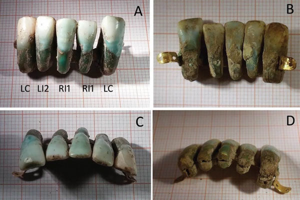 Prótesis dentales muy medievales