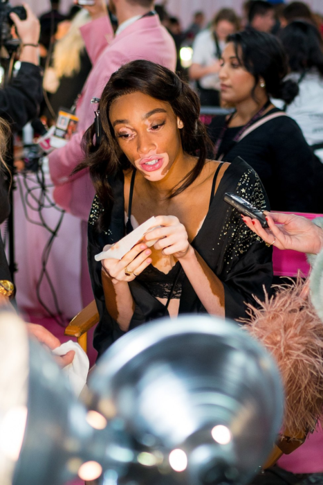 Winnie Harlow al desnudo